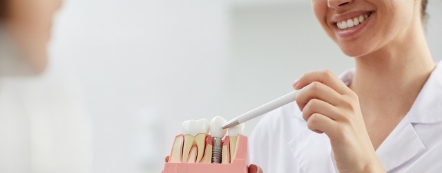 Zahnimplantat: Kosten und Behandlung