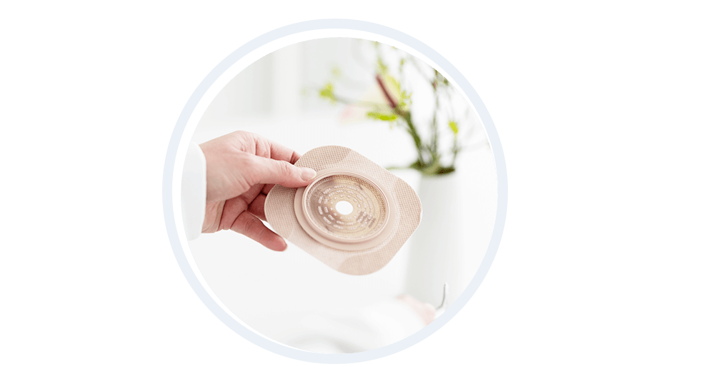 Bild: Stoma-Versorgung