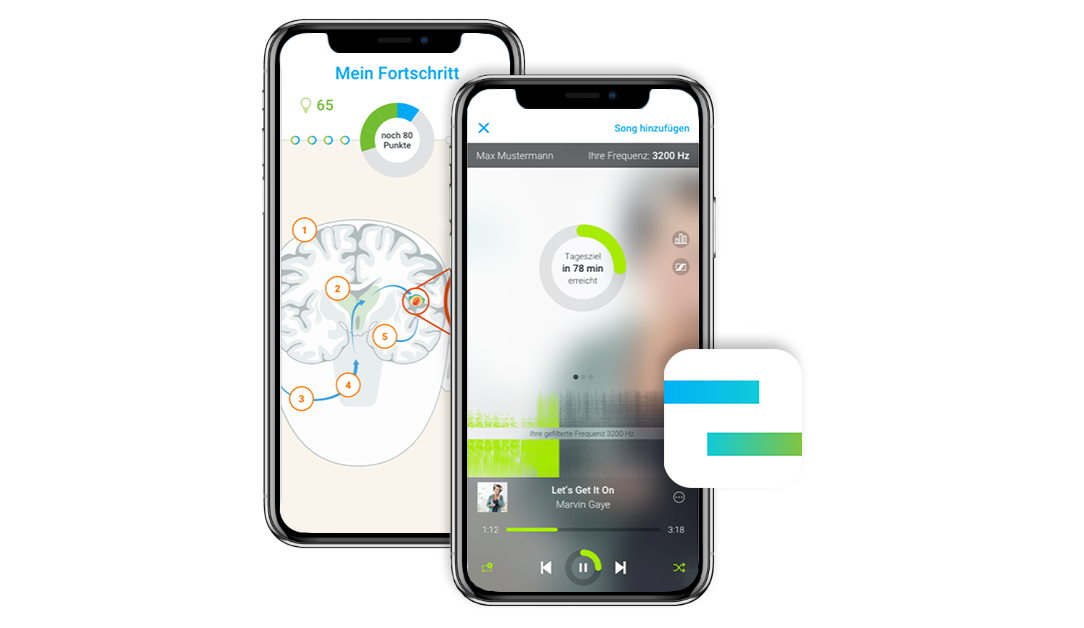 Tinnitus-Therapie via App