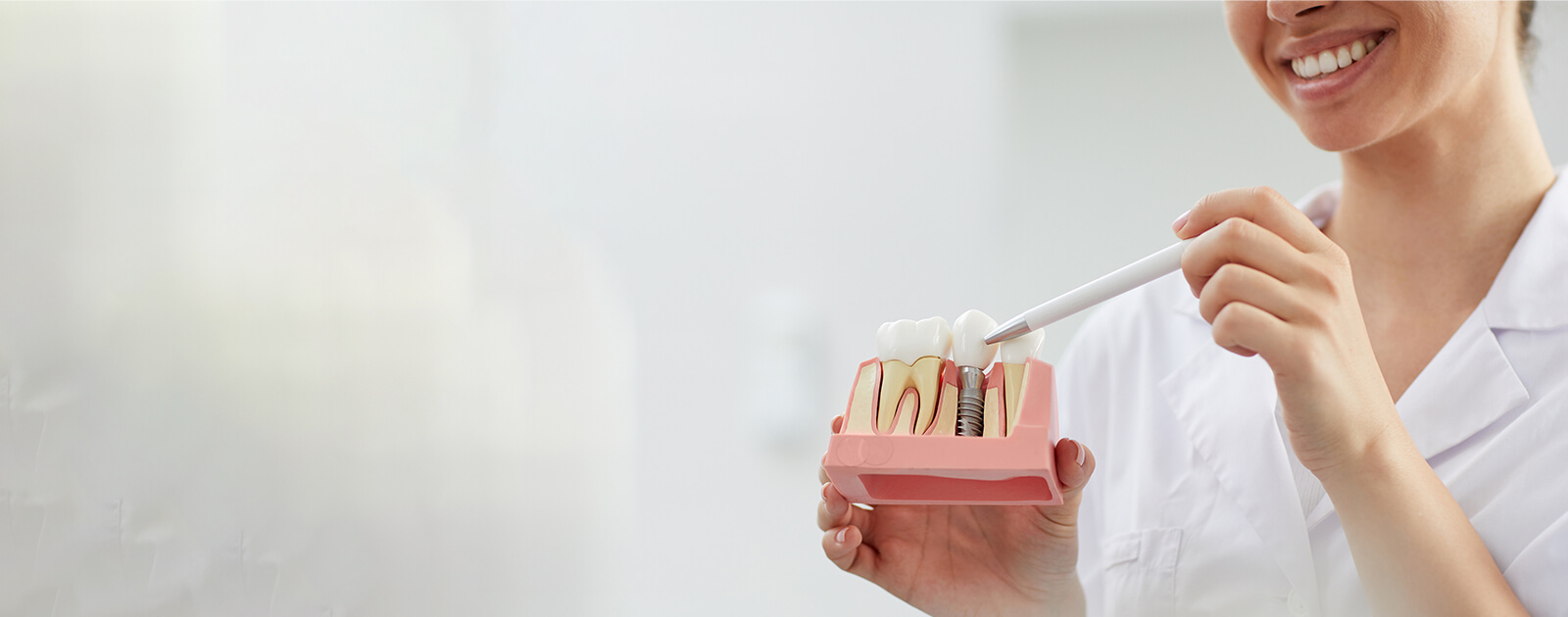 Zahnimplantat: Kosten und Behandlung im Überblick